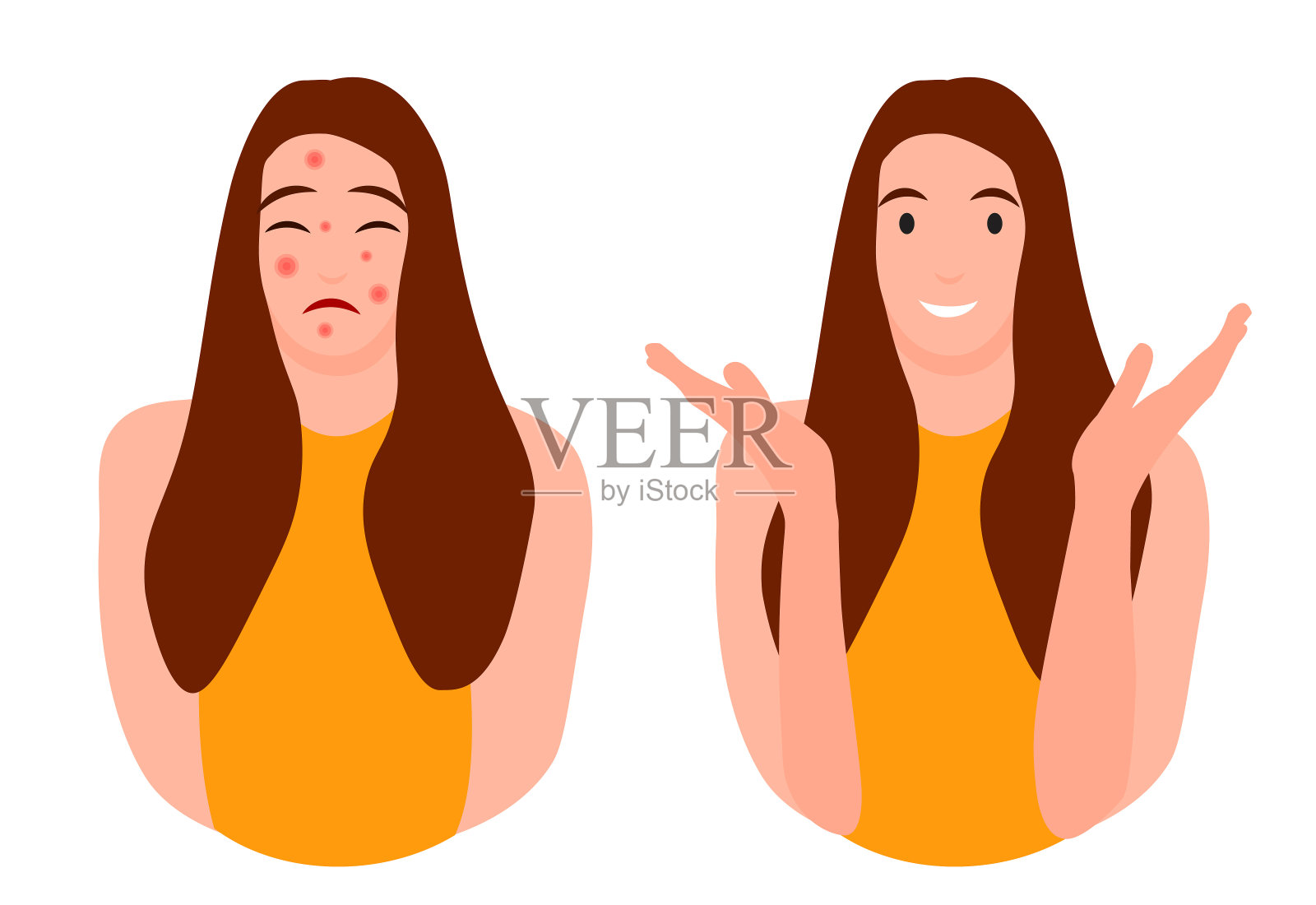 卡通少女角色与没有痤疮。皮肤问题的概念。彩色矢量插图孤立在白色背景。医药美容保健插画图片素材