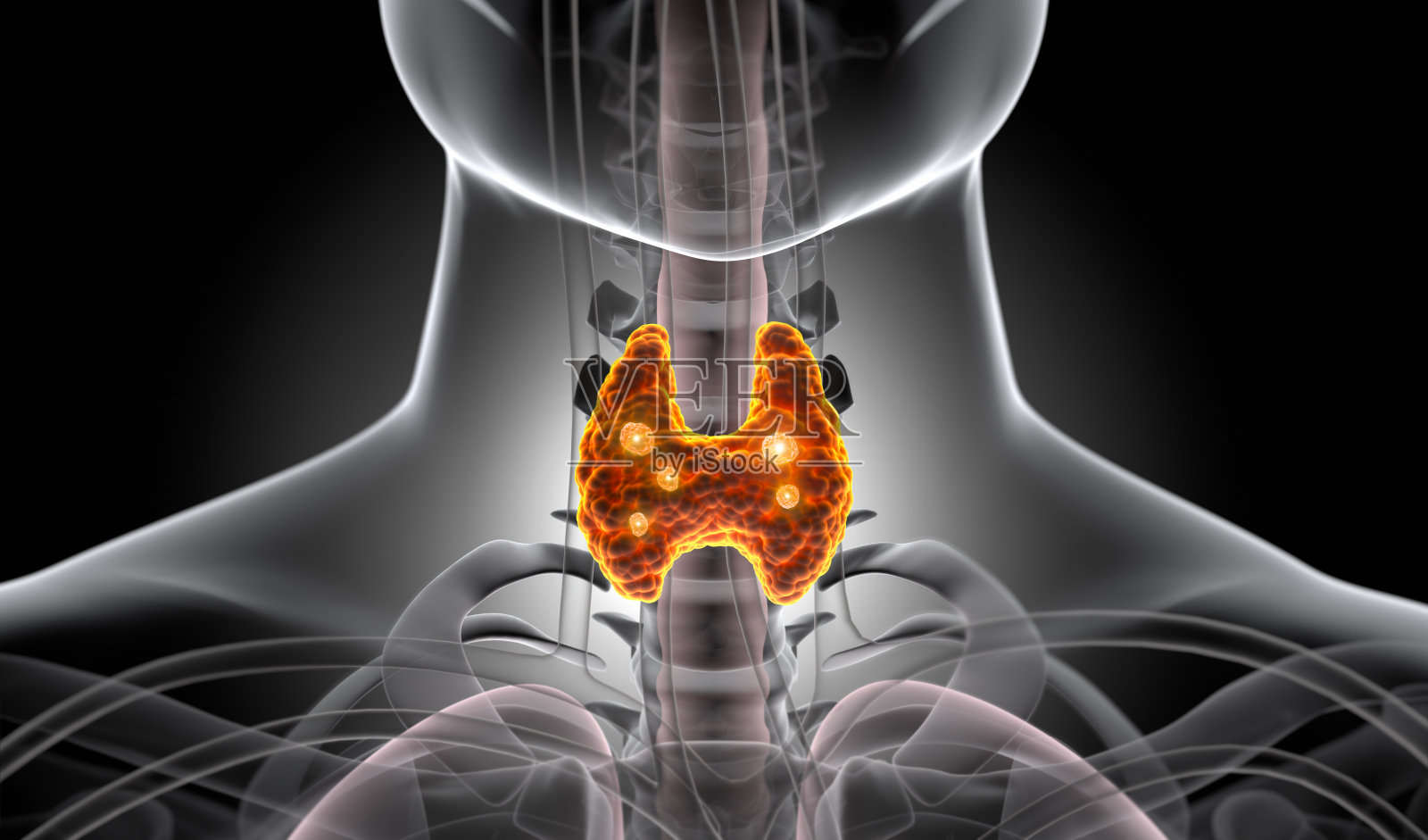 甲状腺照片摄影图片