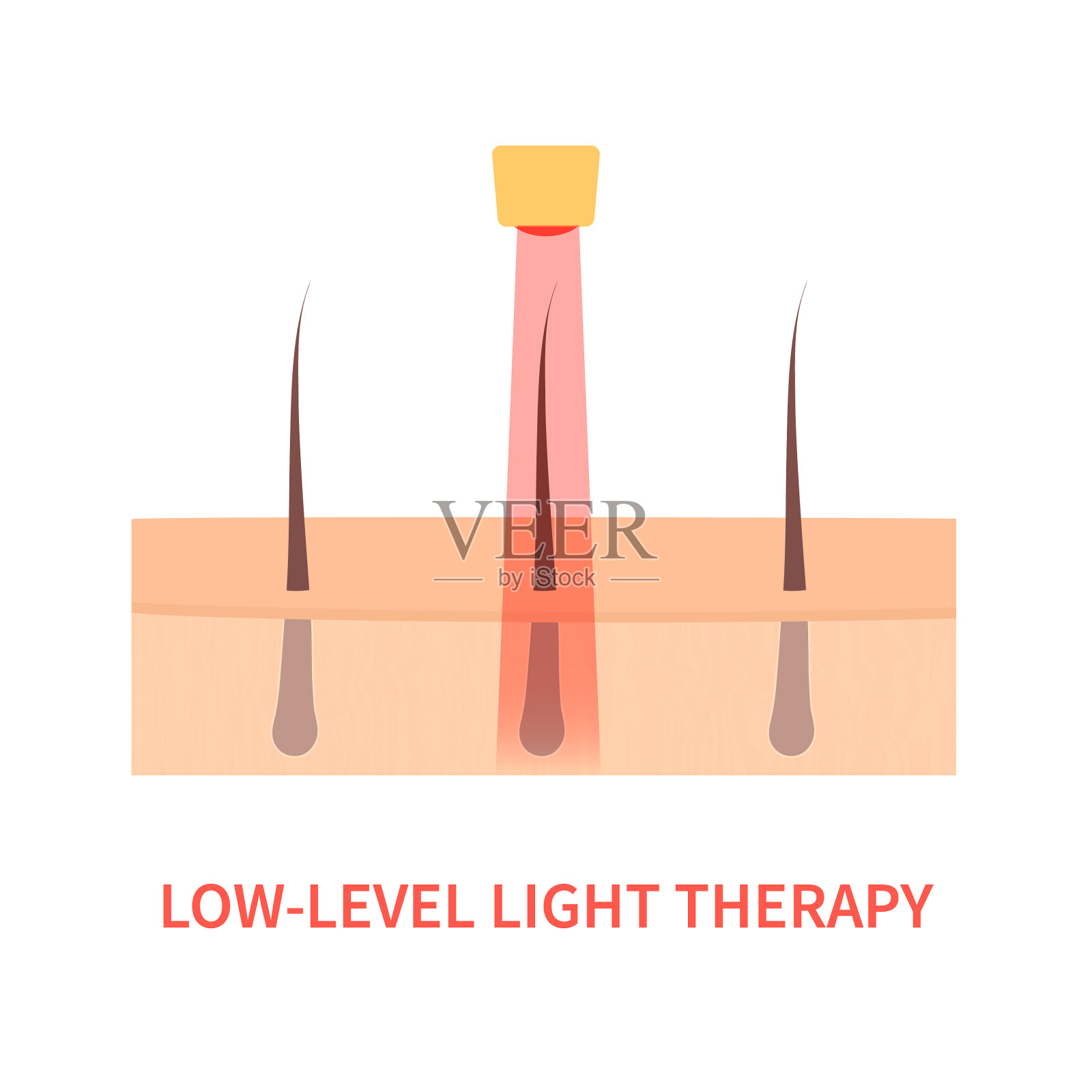 激光红光疗法治疗脱发插画图片素材