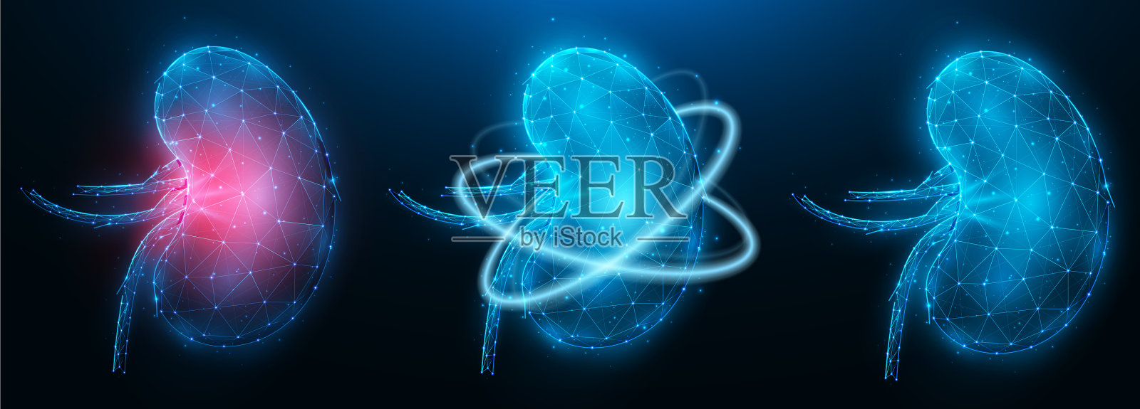 红肿病肾多边形健康插画图片素材