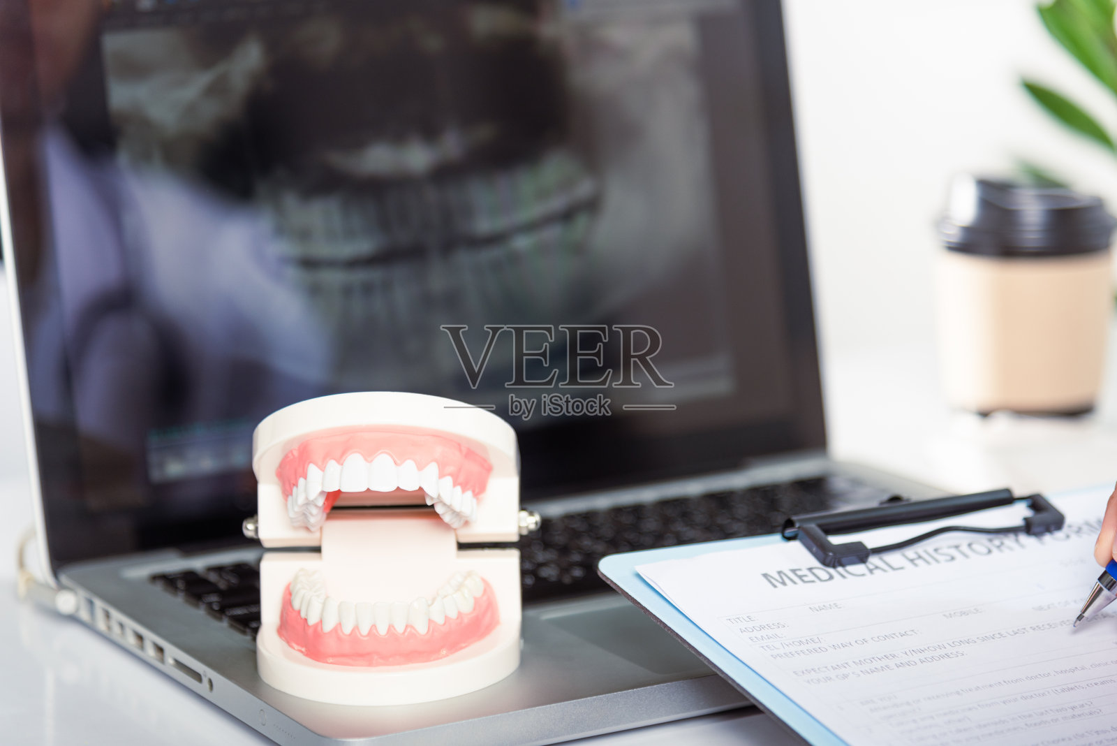 穿着制服的牙科医生将病人的资料以书面核对表的形式写在剪贴板上照片摄影图片