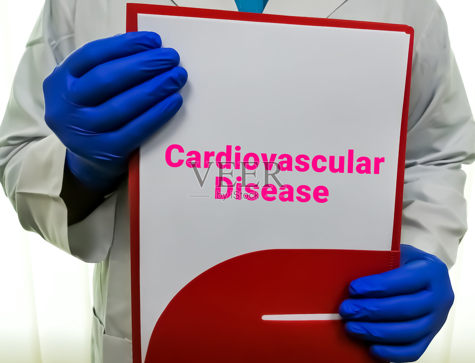 科学家或医生拿着写有医学术语心血管疾病、健康和医学概念的剪贴板。照片摄影图片