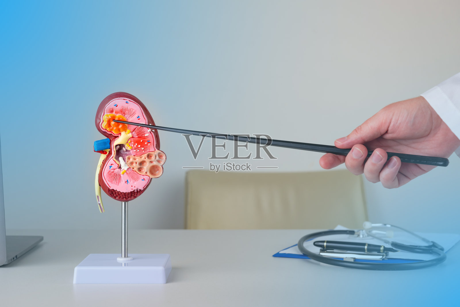 肾科医生指着桌面上的肾脏模型上的肿瘤照片摄影图片
