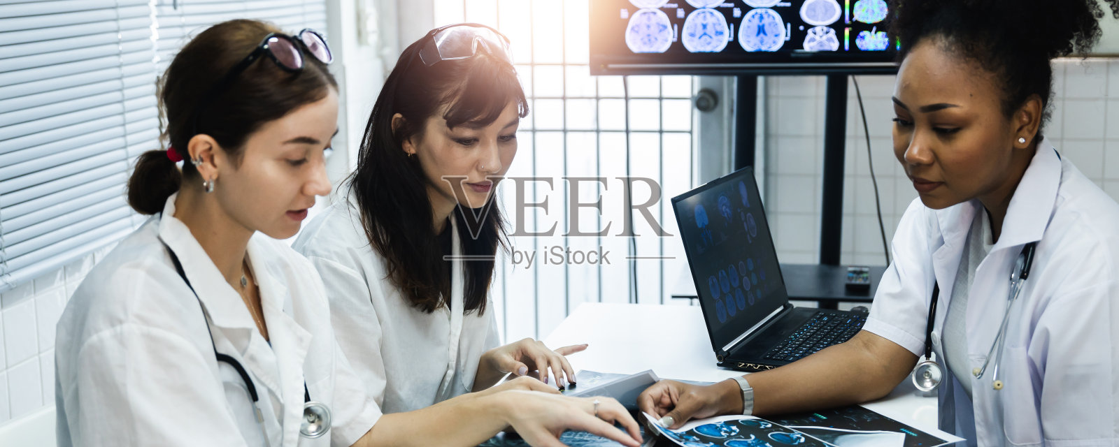 女医生团队检查扫描结果，并在实验室观察监视器，计划和分享医疗知识和经验，使她的同事和患者受益照片摄影图片