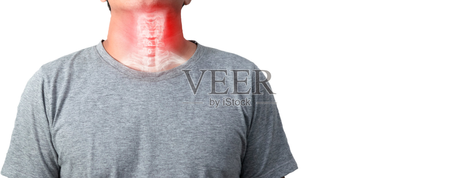 颈骨颈椎病是颈椎的炎症照片摄影图片