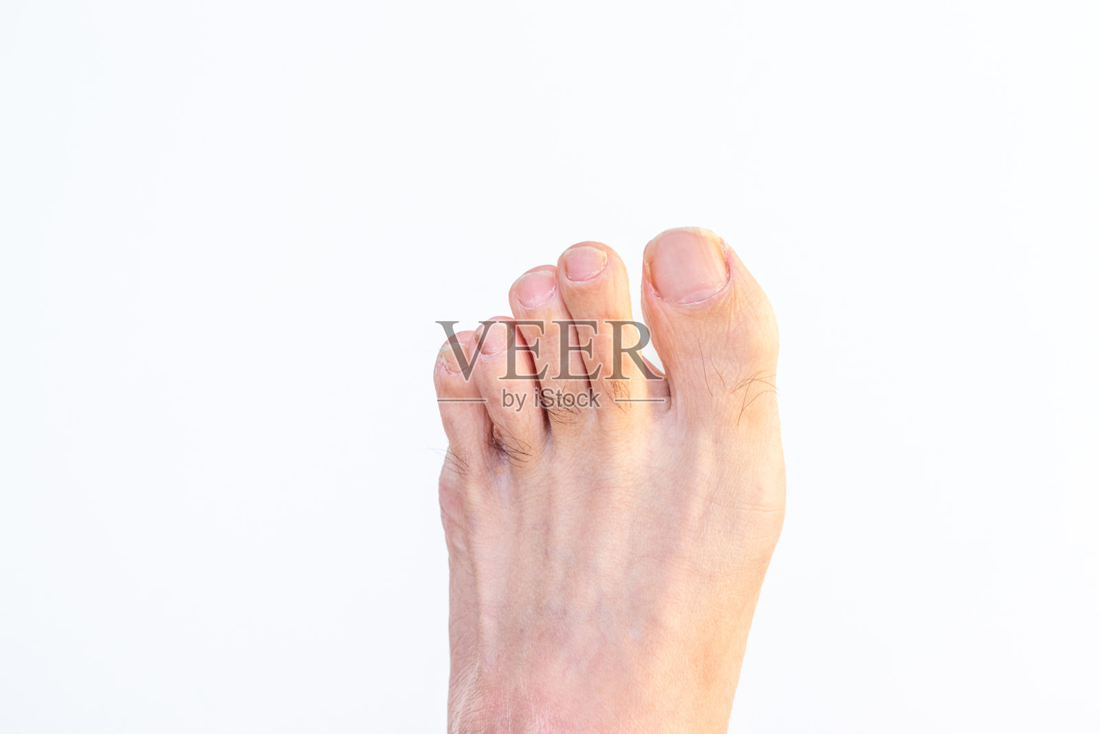 裸露的左腿向前突出照片摄影图片