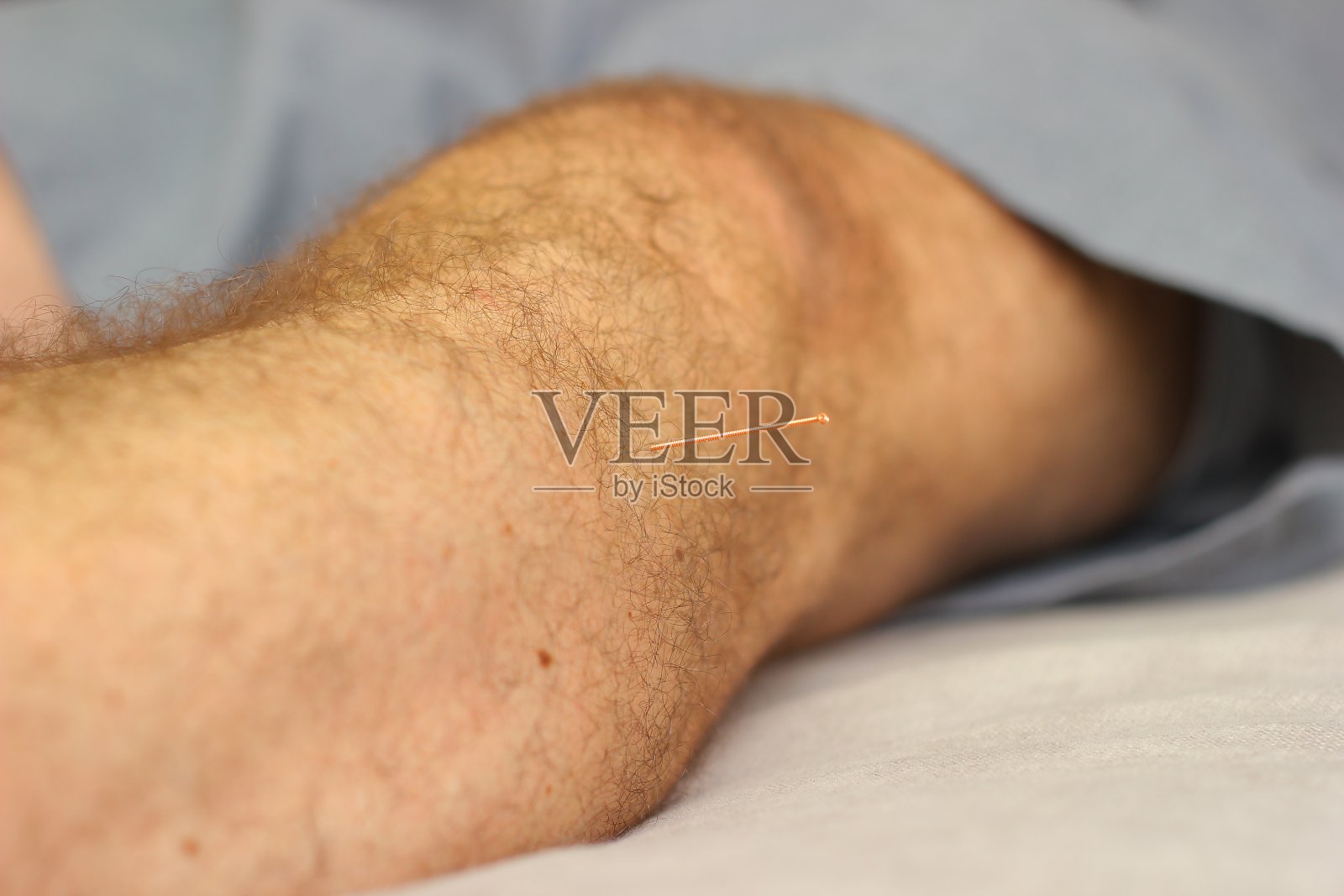 正在接受腿部针灸的男子照片摄影图片