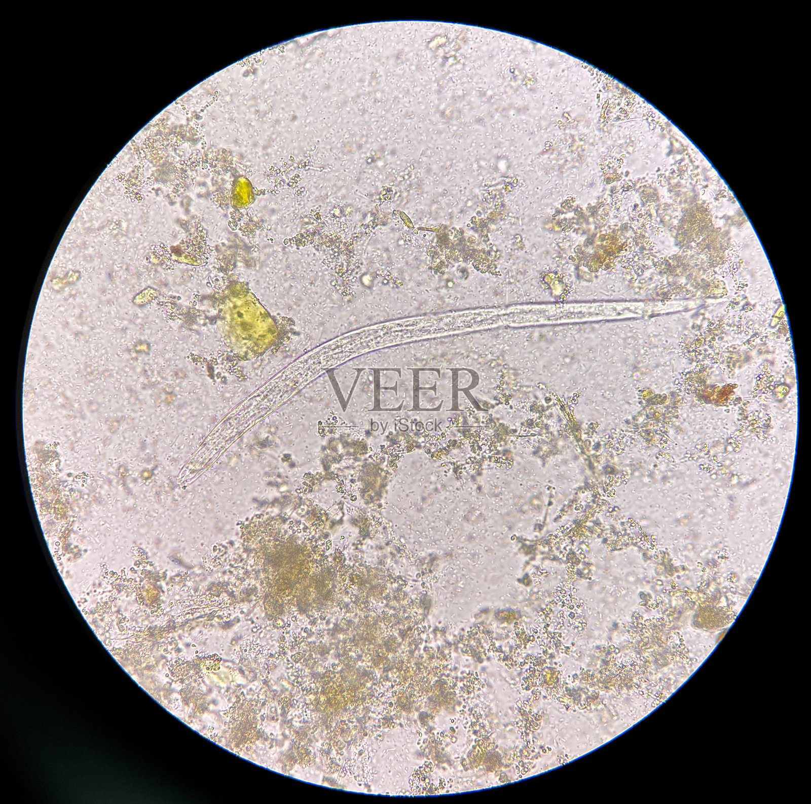 粪检中发现粪粪圆线虫幼虫。照片摄影图片