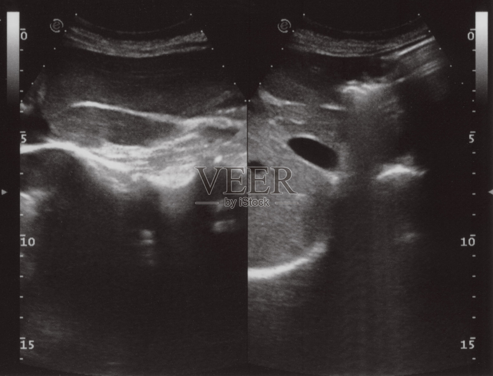 全腹部超声照片摄影图片
