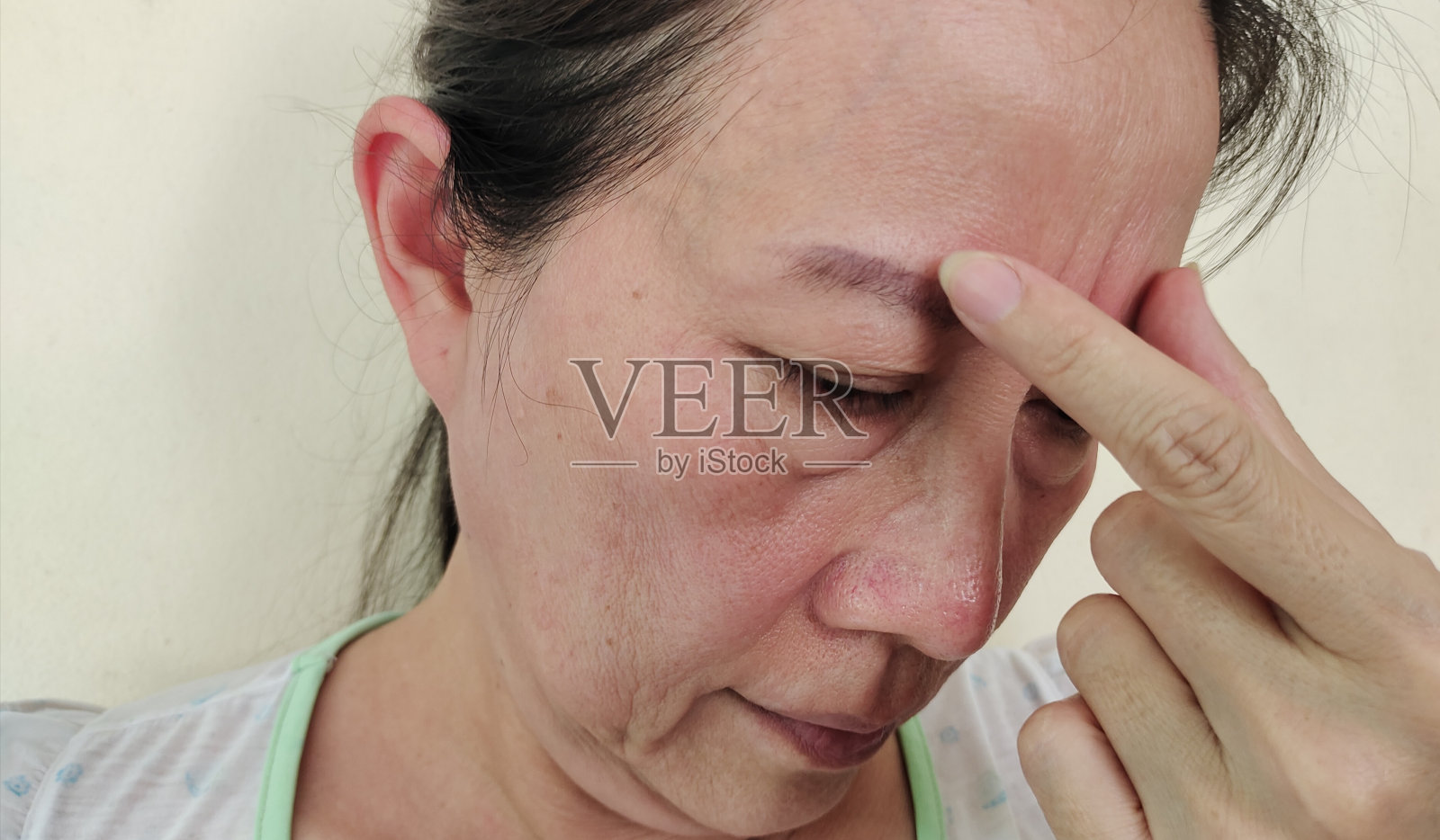 松弛的皱纹下垂，雀斑和瑕疵，前额纹在脸上。照片摄影图片