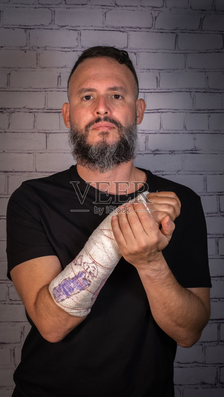 肖像的脸，白人男子的胡子和黑色t恤，断臂石膏与照片摄影图片