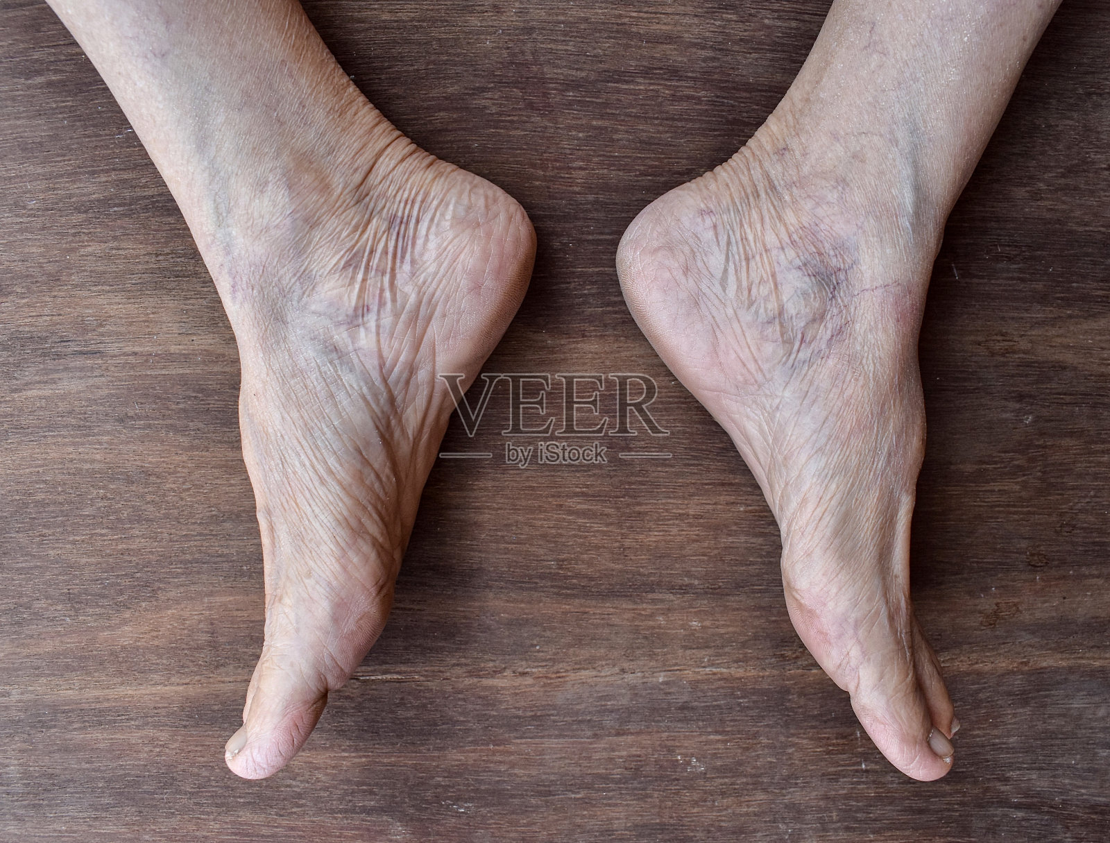 皮肤皱纹和突出的静脉通过亚洲妇女的薄脚皮肤可见。照片摄影图片