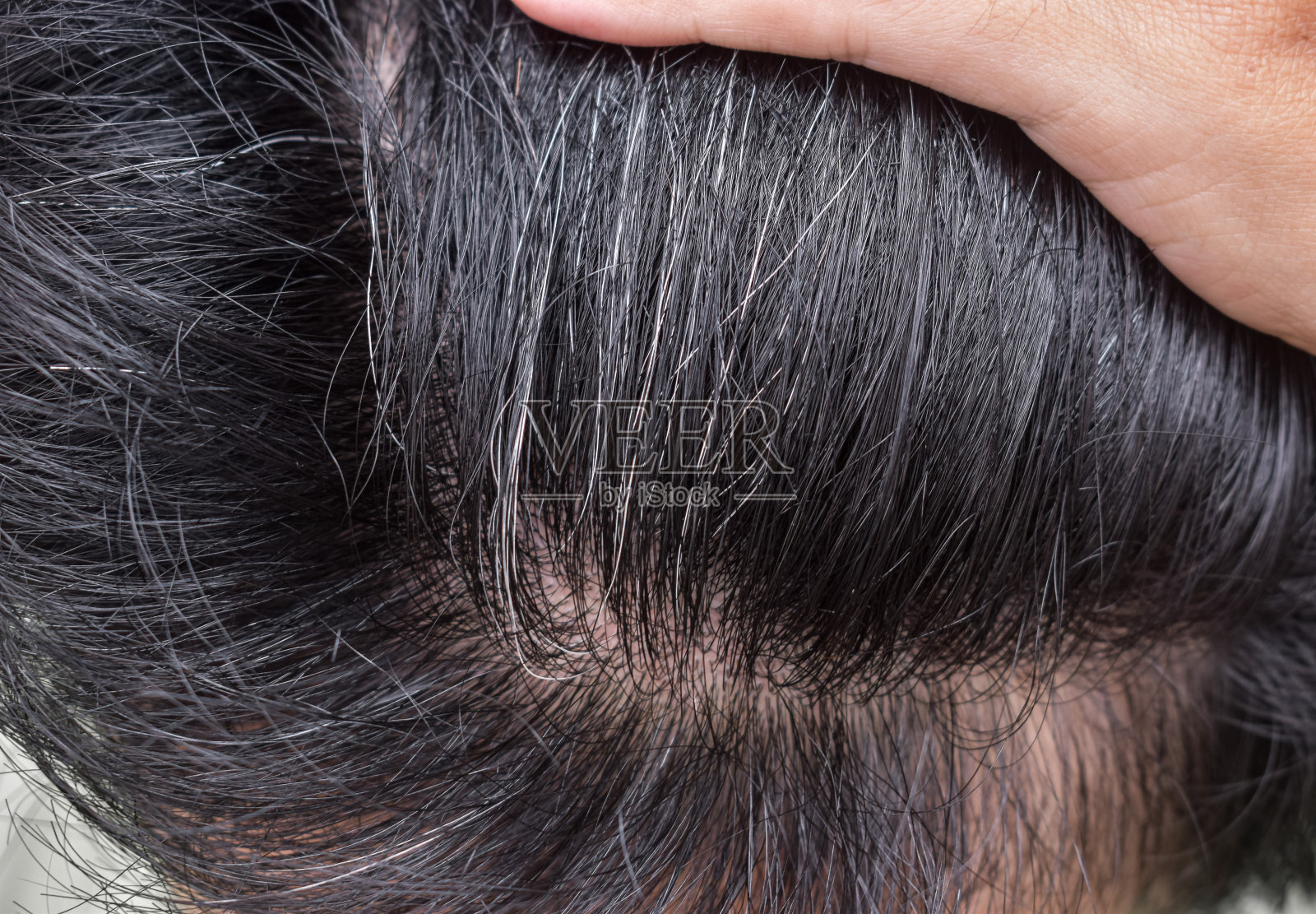 过早美白头发。早期老化。头发的灰色变化。照片摄影图片