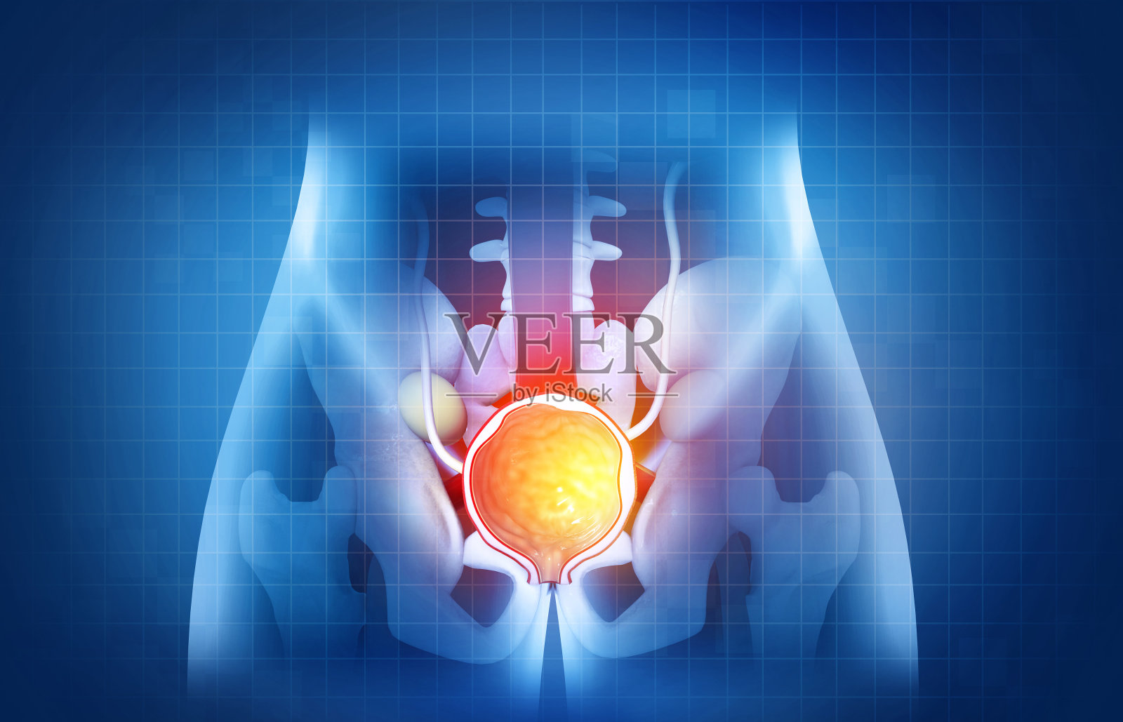 前列腺疾病，良性前列腺增生(BPH)，前列腺癌。三维演示照片摄影图片