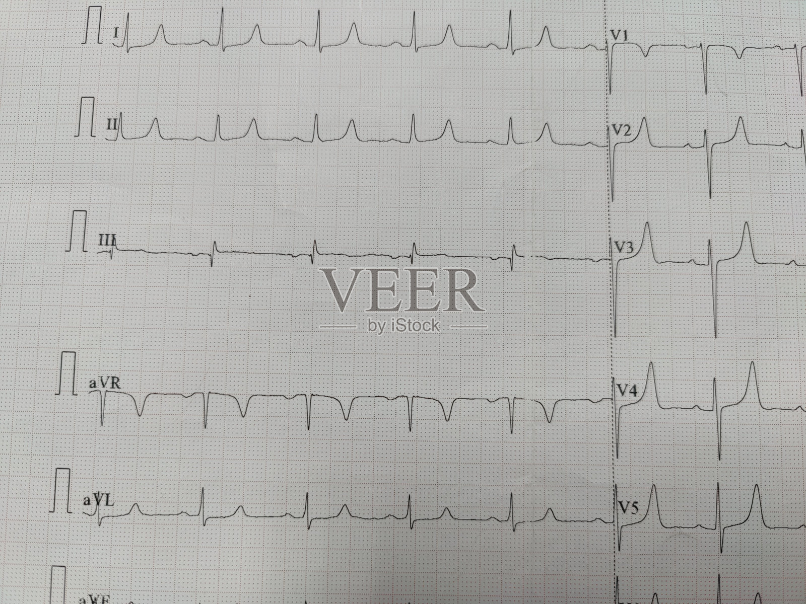 心电图照片摄影图片
