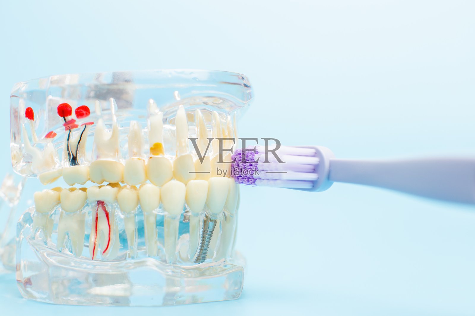 牙医假牙，牙龈，牙根特写。研究牙病概念照片摄影图片