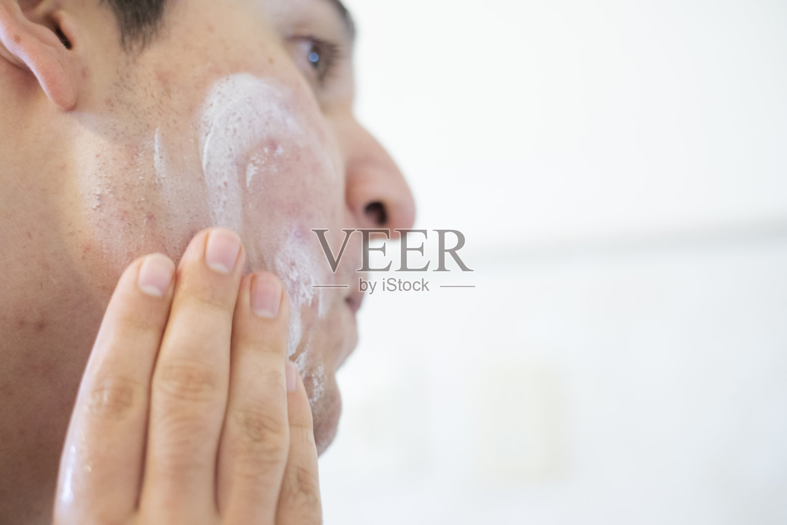 青春痘青年照片摄影图片