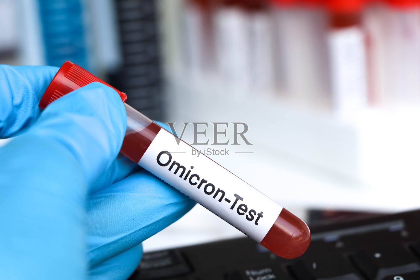 欧米克隆测试，从血液中寻找异常照片摄影图片