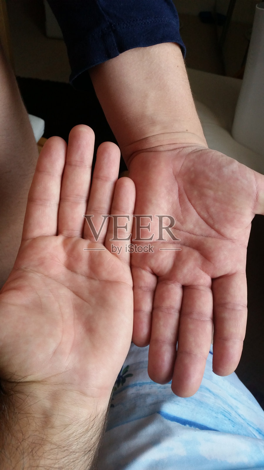 怀孕和手肿照片摄影图片