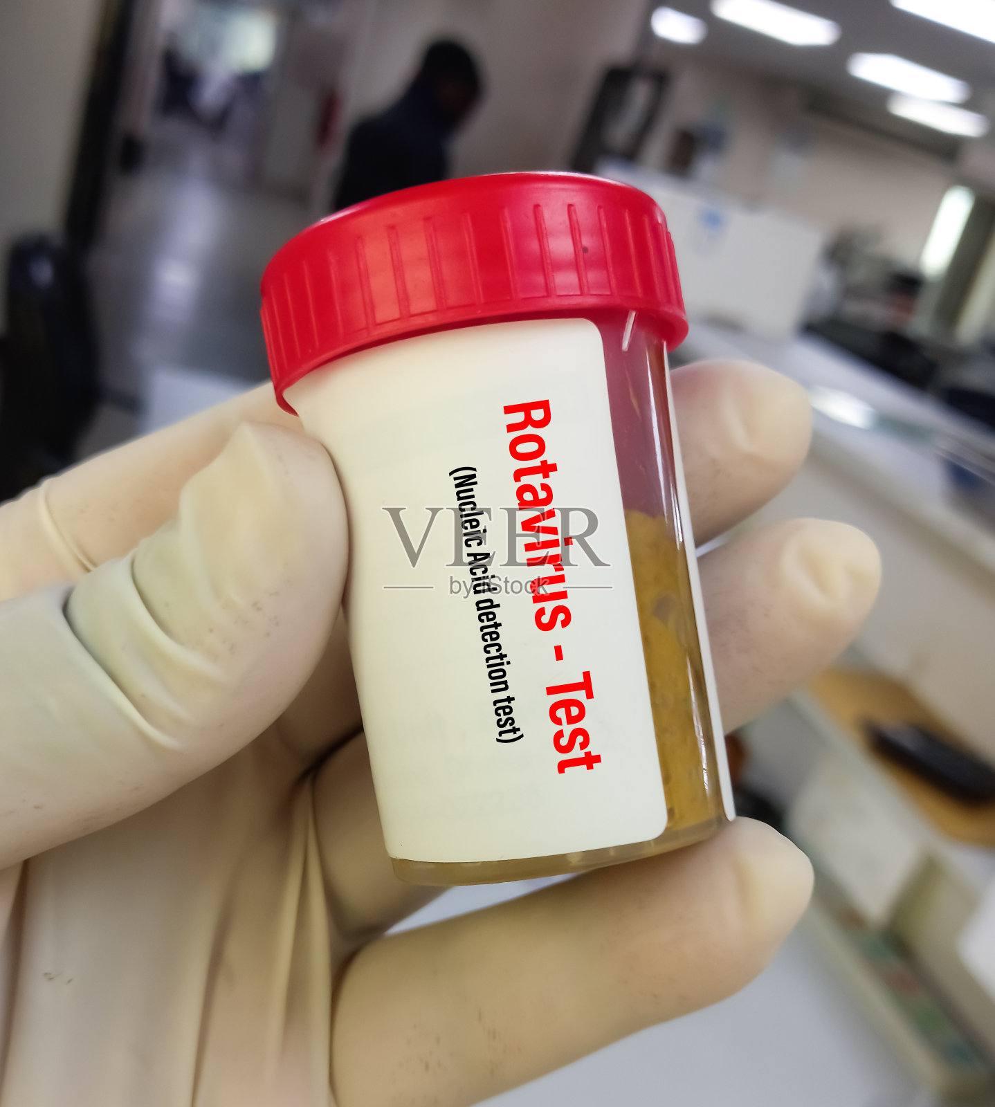 生物化学家持有粪便样本进行轮状病毒检测，以诊断轮状病毒感染。轮状病毒抗原测试。病毒性肠胃炎。照片摄影图片