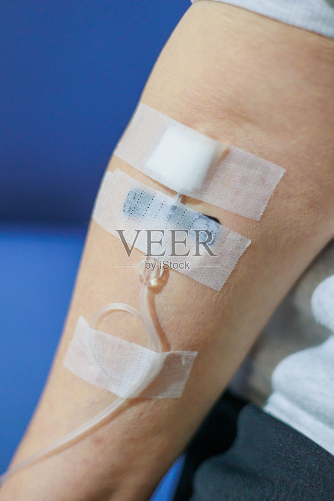 一个打着点滴的女人的手臂照片摄影图片