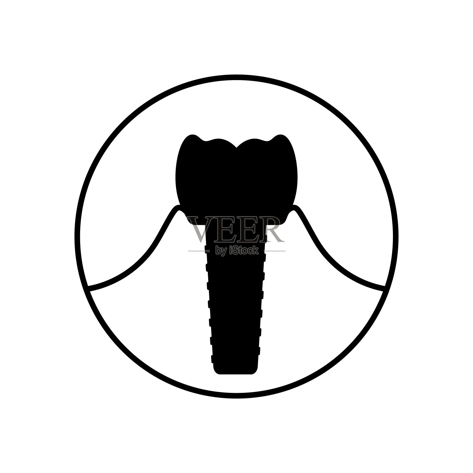 牙科植体手术插画图片素材