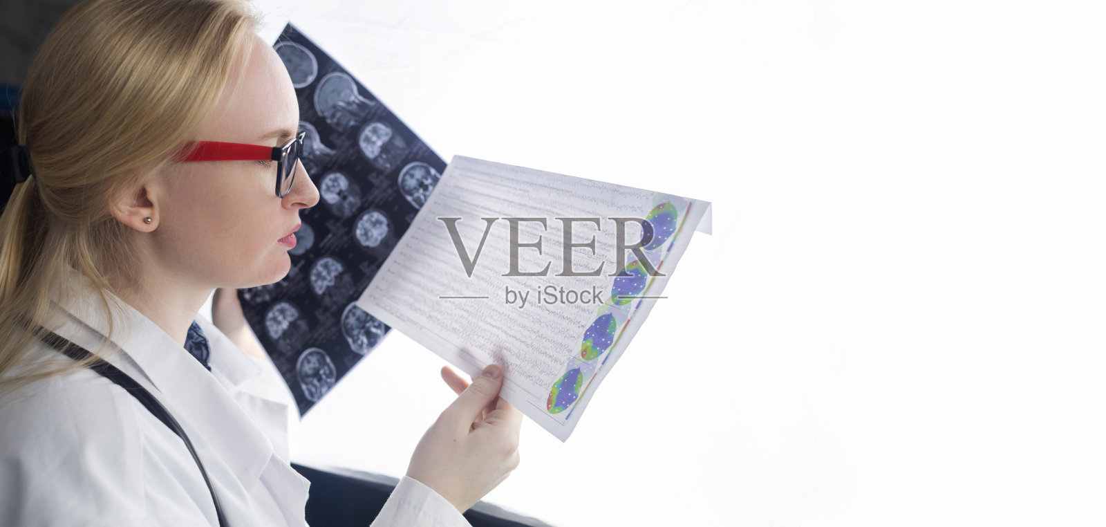 癫痫学家检查患者的MRI和脑电图。概念治疗癫痫，帮助患有这种疾病的人。神经学家的工作。大脑病理学癫痫活动照片摄影图片