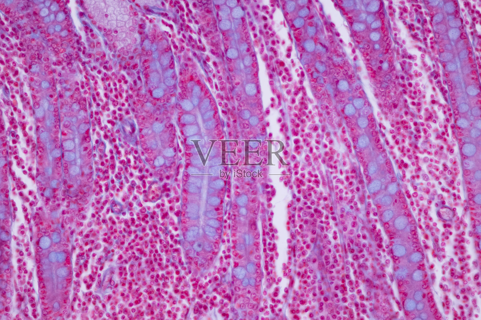 人小肠(十二指肠)、大肠及胃组织。照片摄影图片
