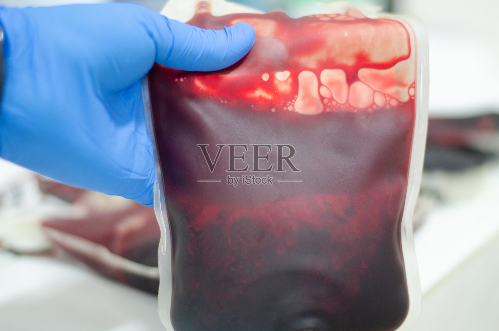 实验室有血袋。照片摄影图片