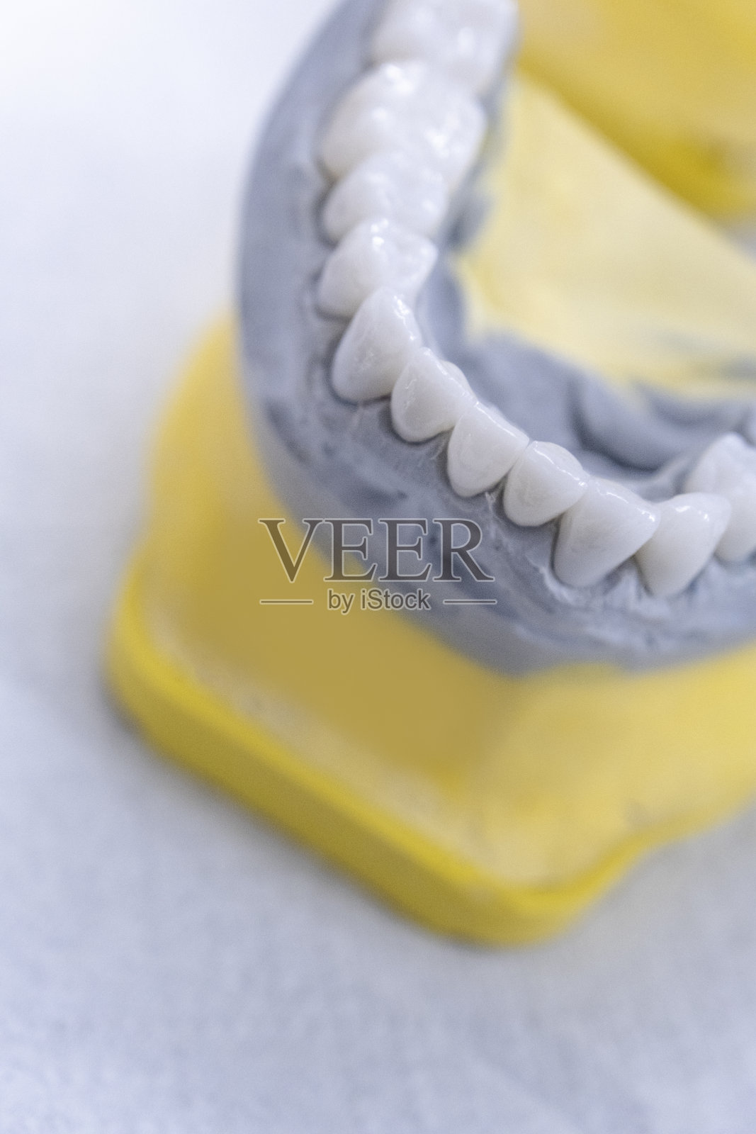 牙医植牙照片摄影图片