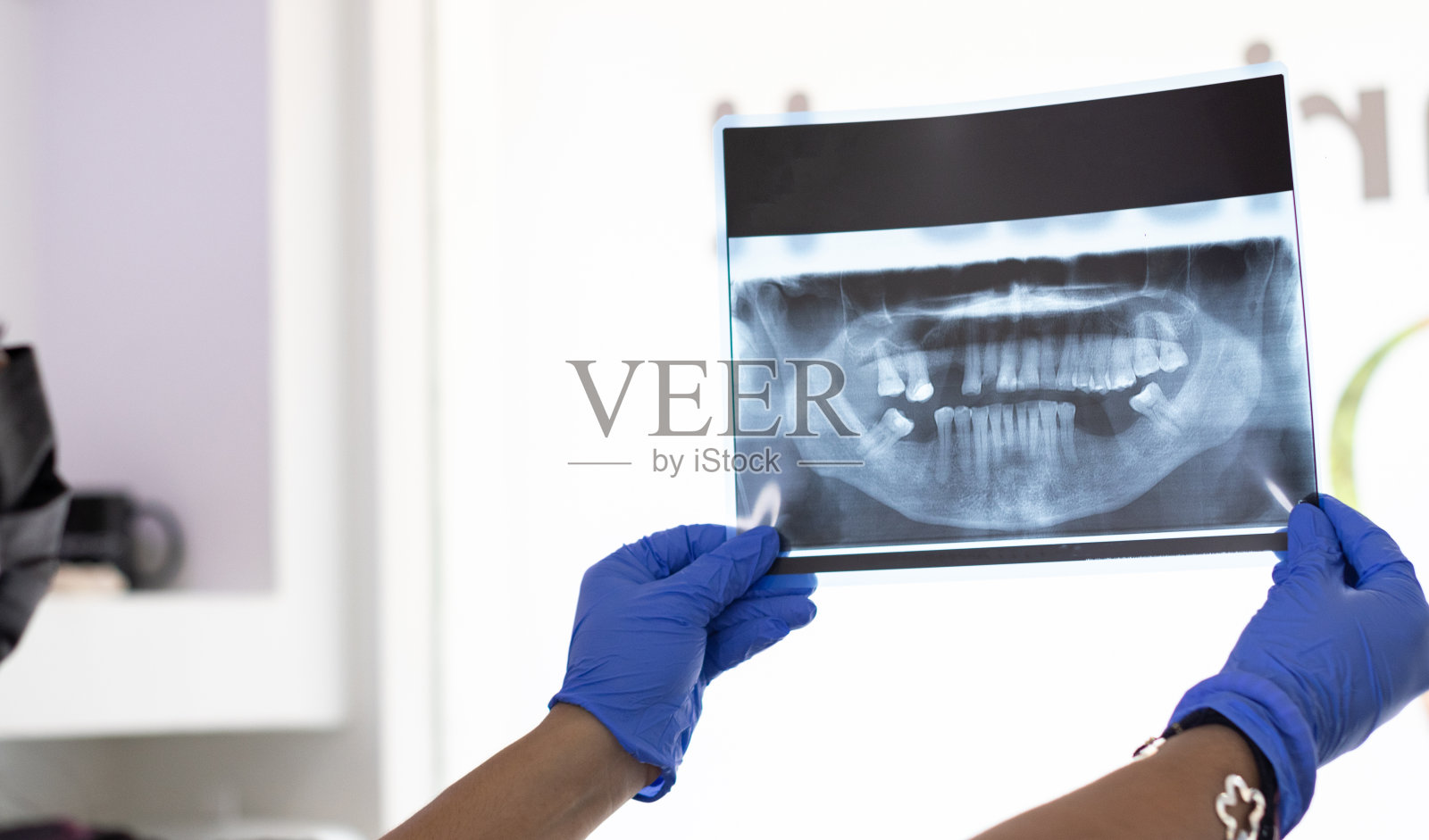 医生看x光片照片摄影图片