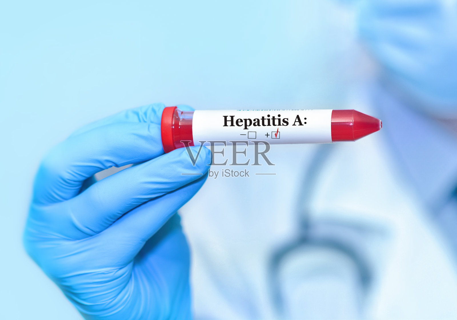 医生手里拿着一根甲型肝炎病毒(HAV)测试阳性的血液样管。横幅。本空间照片摄影图片