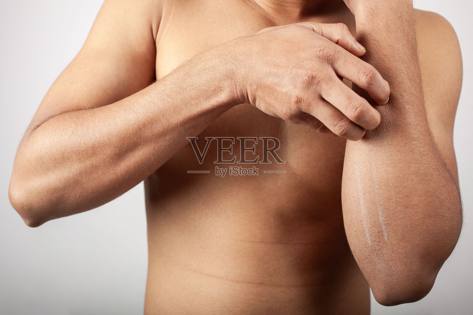 白人男子前臂皮肤发痒照片摄影图片