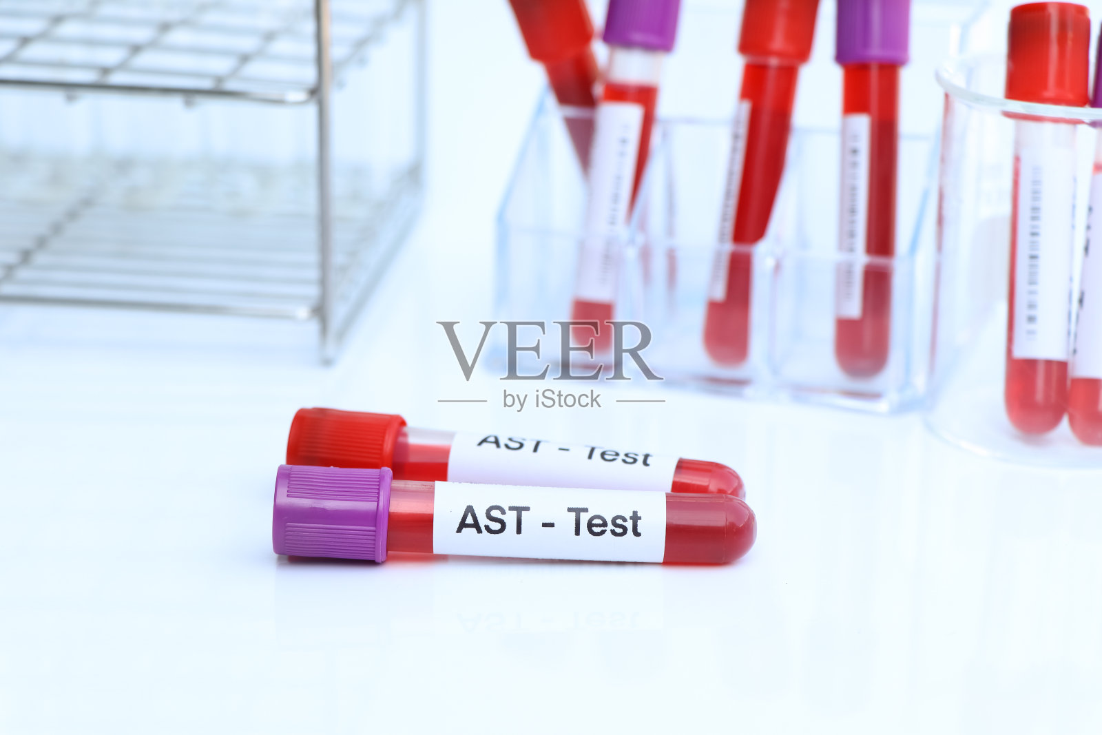 AST测试，从血液中寻找异常照片摄影图片