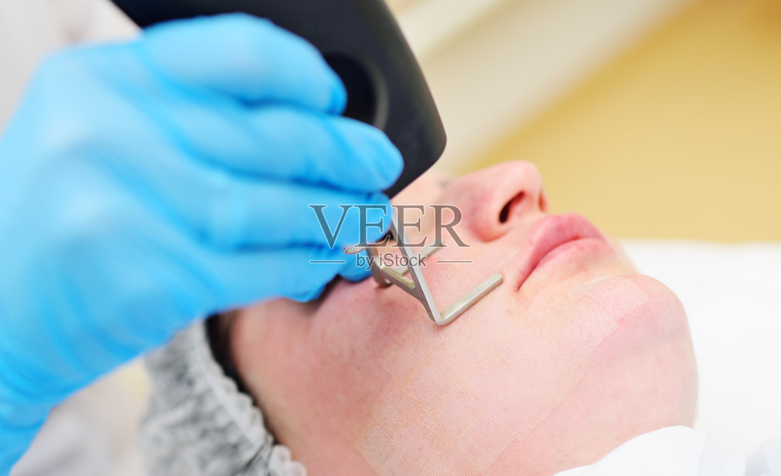 在一家现代美容诊所里，美容师使用二氧化碳分数烧蚀激光来恢复皮肤活力并去除疤痕。照片摄影图片