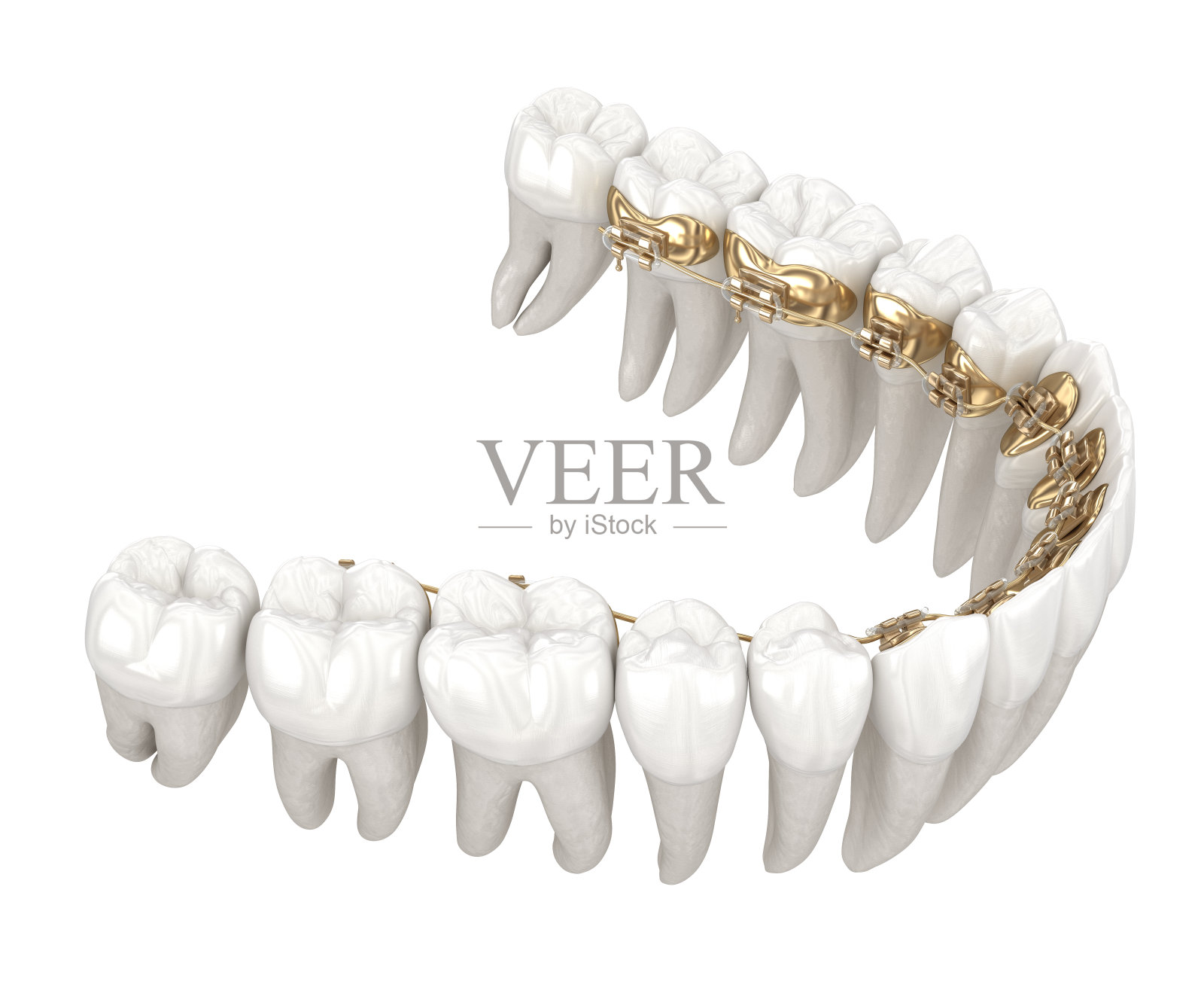 舌花系统。金牙套的3D插图概念照片摄影图片