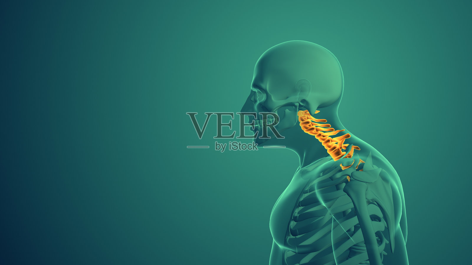 颈椎姿势综合征的医学背景照片摄影图片