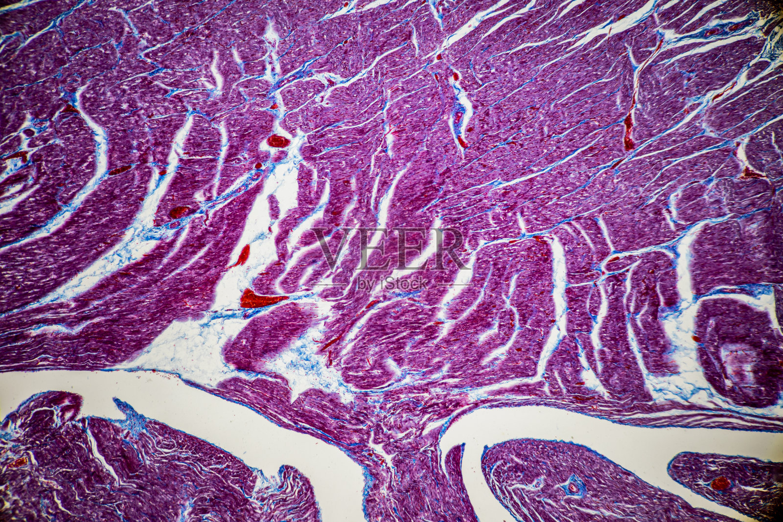 人体心肌，平滑肌，静脉，动脉和淋巴结组织。照片摄影图片