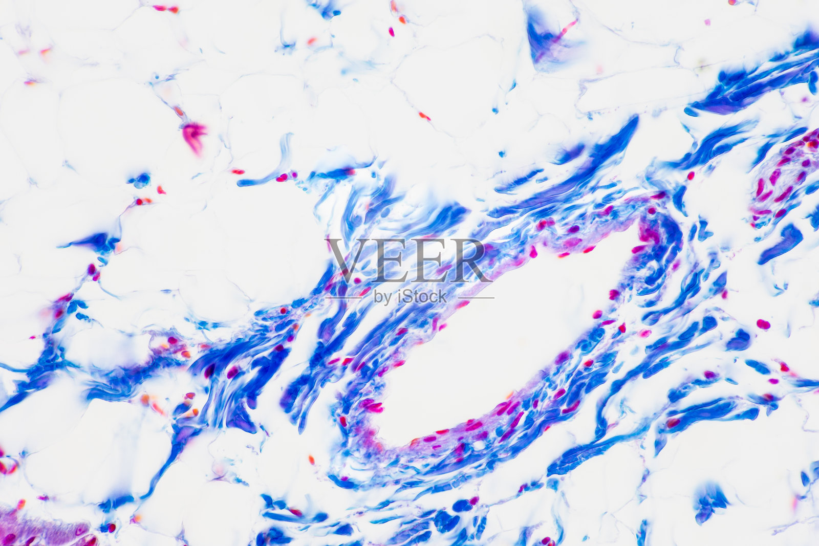 人体心肌，平滑肌，静脉，动脉和淋巴结组织。照片摄影图片