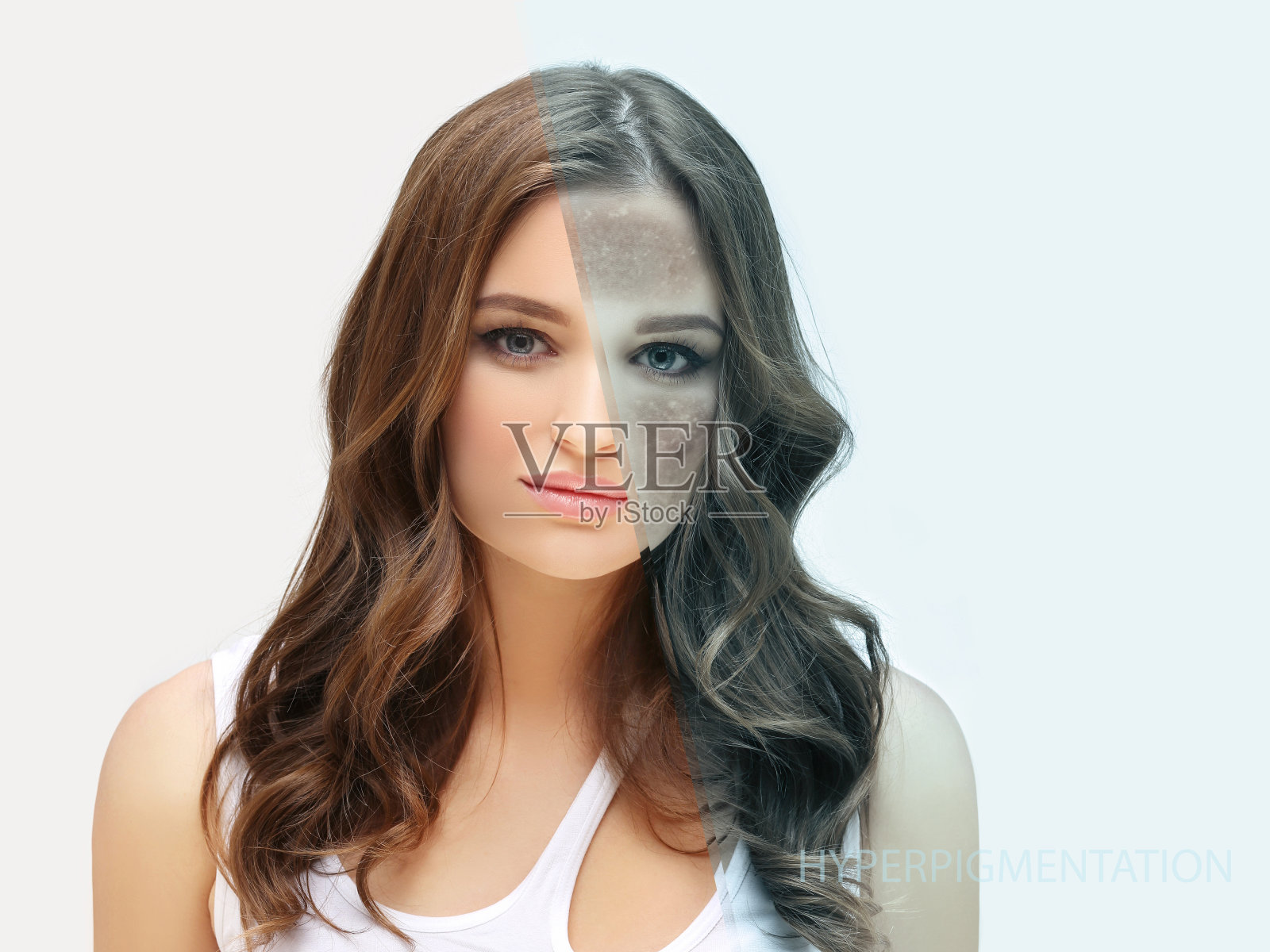 黑斑，雀斑，色素沉着(黄褐斑或黄褐斑)，概念-皮肤提亮，皮肤美白，果酸，AHA，皮肤提亮照片摄影图片