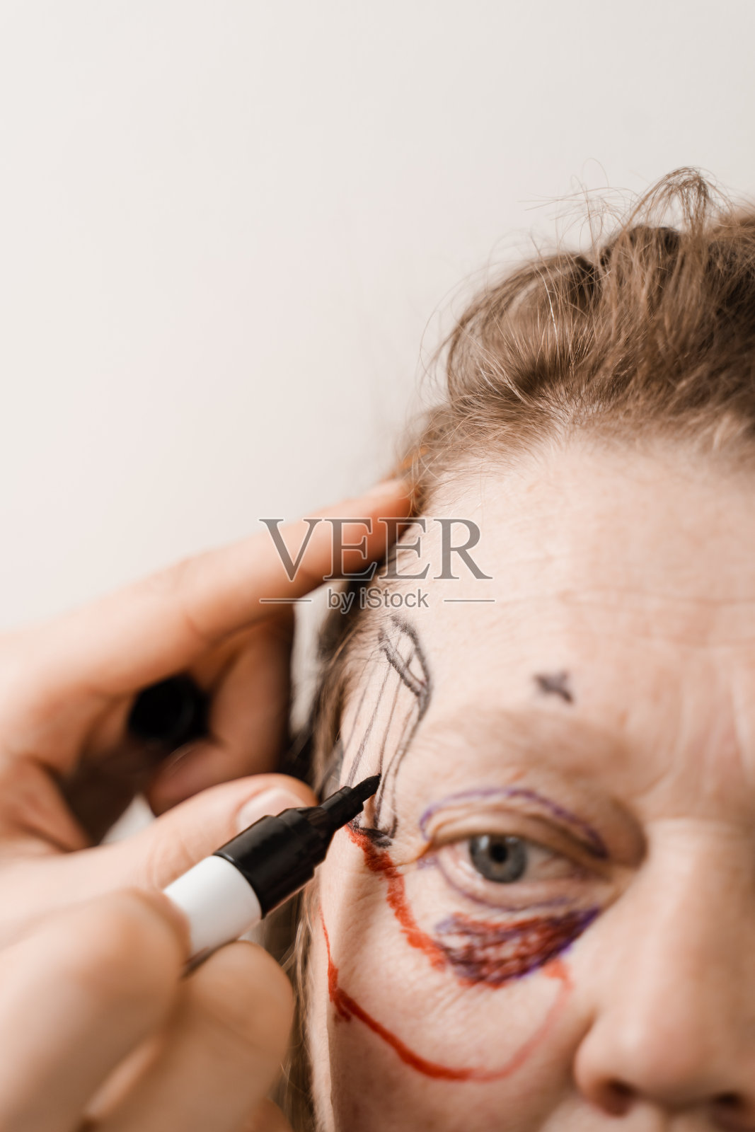 抬眉眉固定术是一种将眉毛缝合到下面的骨头上的方法。整容手术前面部眉部提拉的棕色标记特写。照片摄影图片