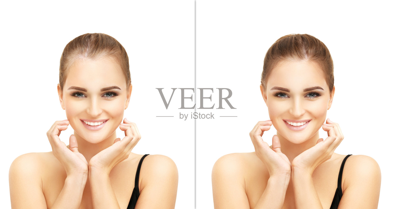 斑秃，女性型秃顶，脱发治疗，植发，植发手术照片摄影图片