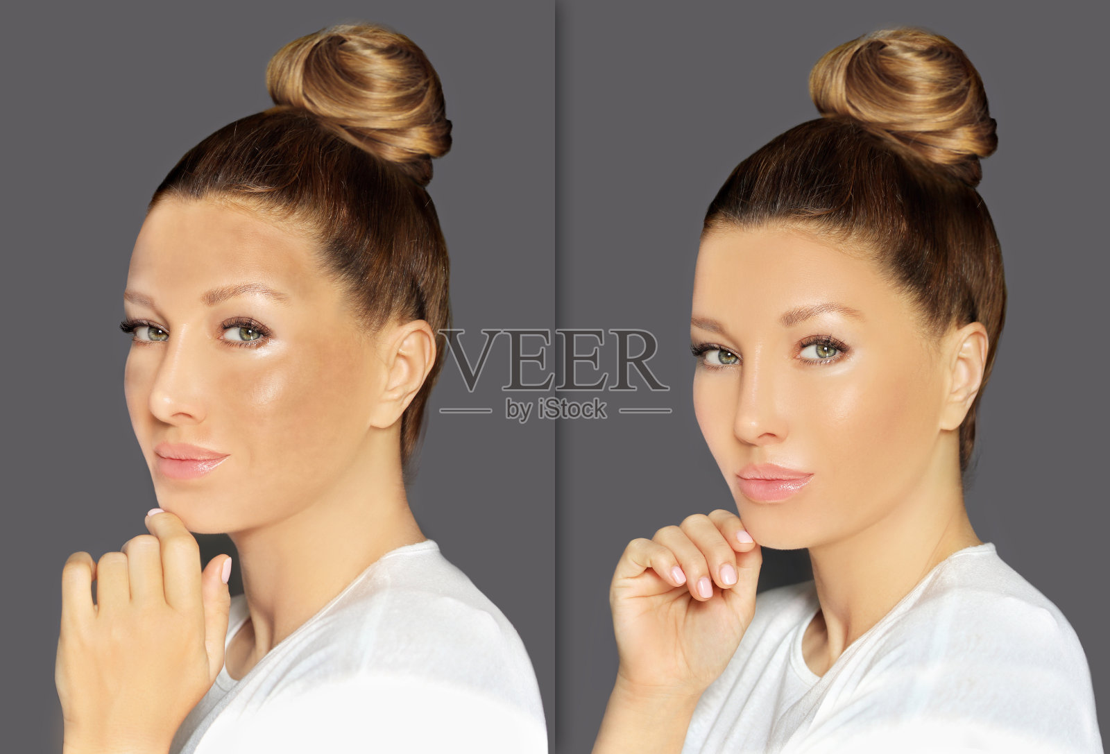 黑斑，雀斑，色素沉着(黄褐斑或黄褐斑)，概念-皮肤提亮，皮肤美白，果酸，AHA，皮肤提亮照片摄影图片