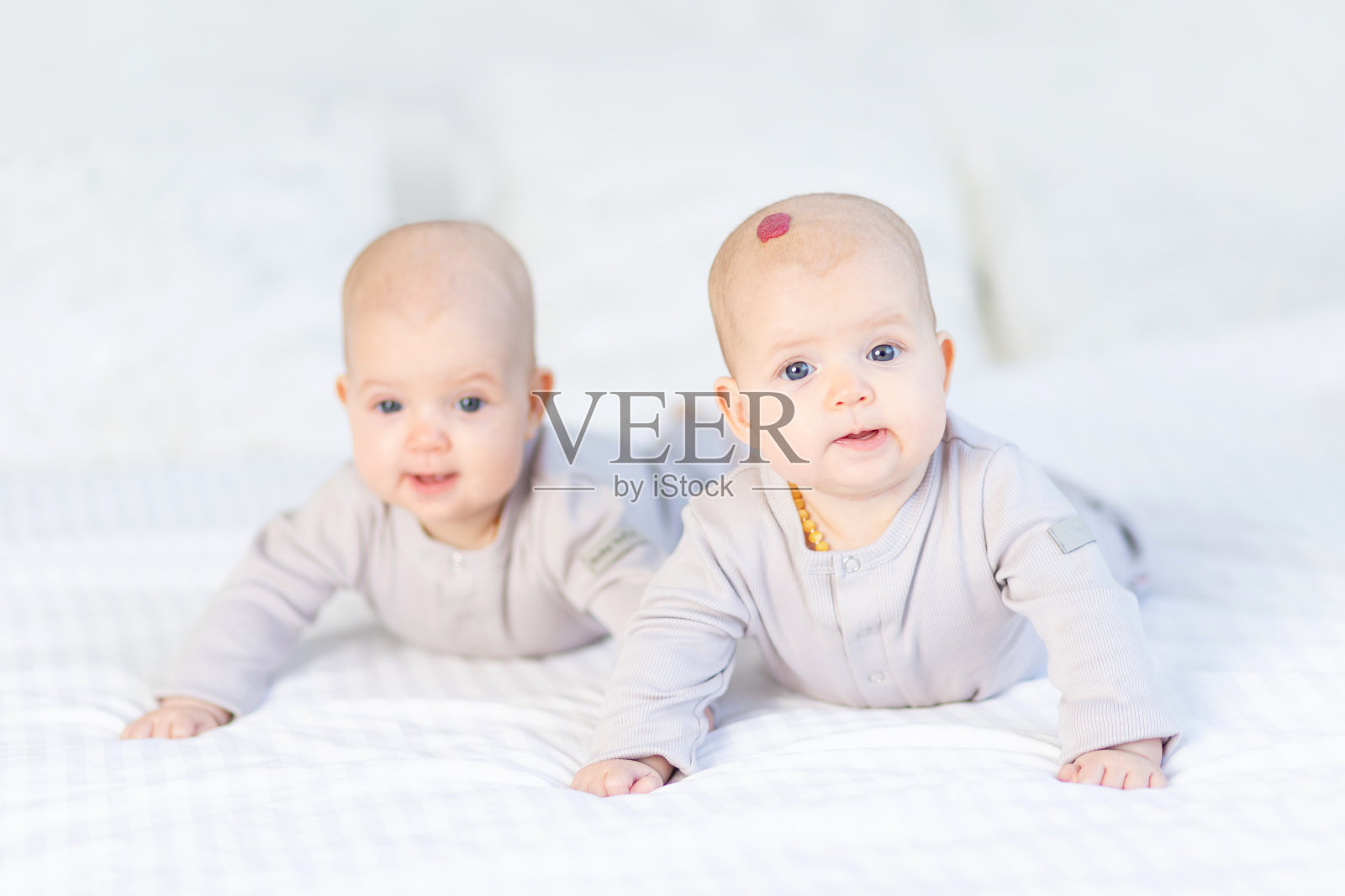 一个头上长了血管瘤或肿瘤的小孩，两个新生儿，一个双胞胎婴儿，一个穿着棉衣的女孩趴在家里白色的床上微笑照片摄影图片