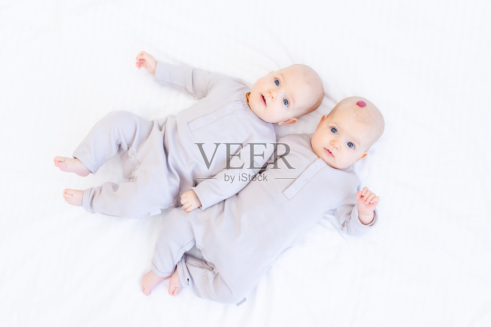 一个头上长了血管瘤或肿瘤的小孩，两个新生儿，一个双胞胎婴儿，一个穿着棉衣的女孩躺在家里白色的床上微笑着照片摄影图片