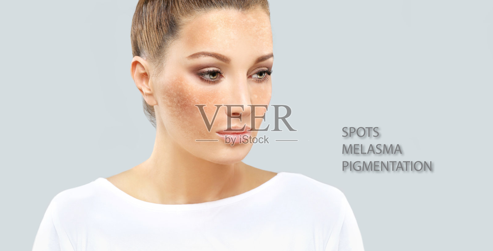 黑斑，雀斑，色素沉着(黄褐斑或黄褐斑)，概念-皮肤提亮，皮肤美白，果酸，AHA，皮肤提亮照片摄影图片