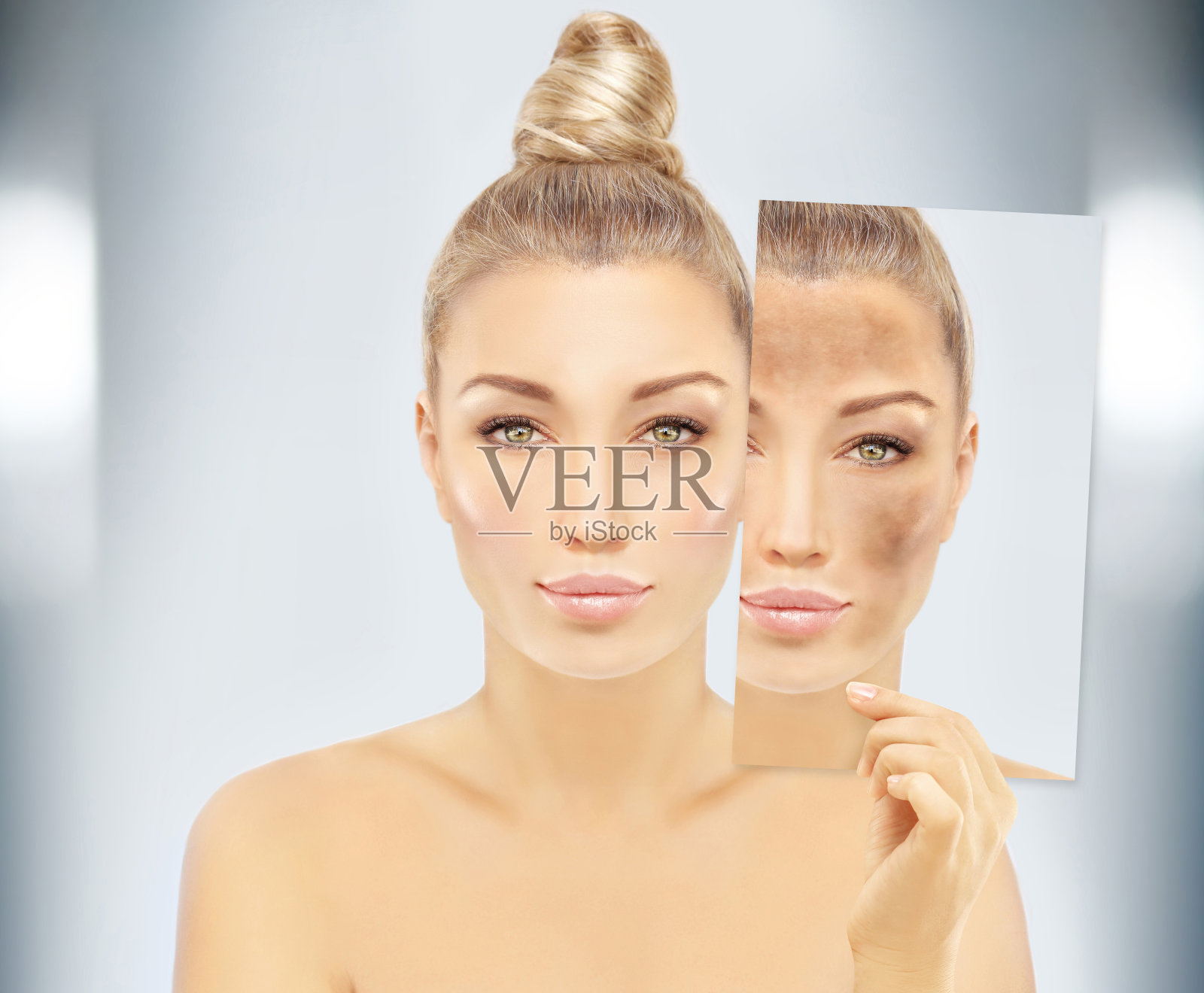 黑斑，雀斑，色素沉着(黄褐斑或黄褐斑)，概念-皮肤提亮，皮肤美白，果酸，AHA，皮肤提亮照片摄影图片