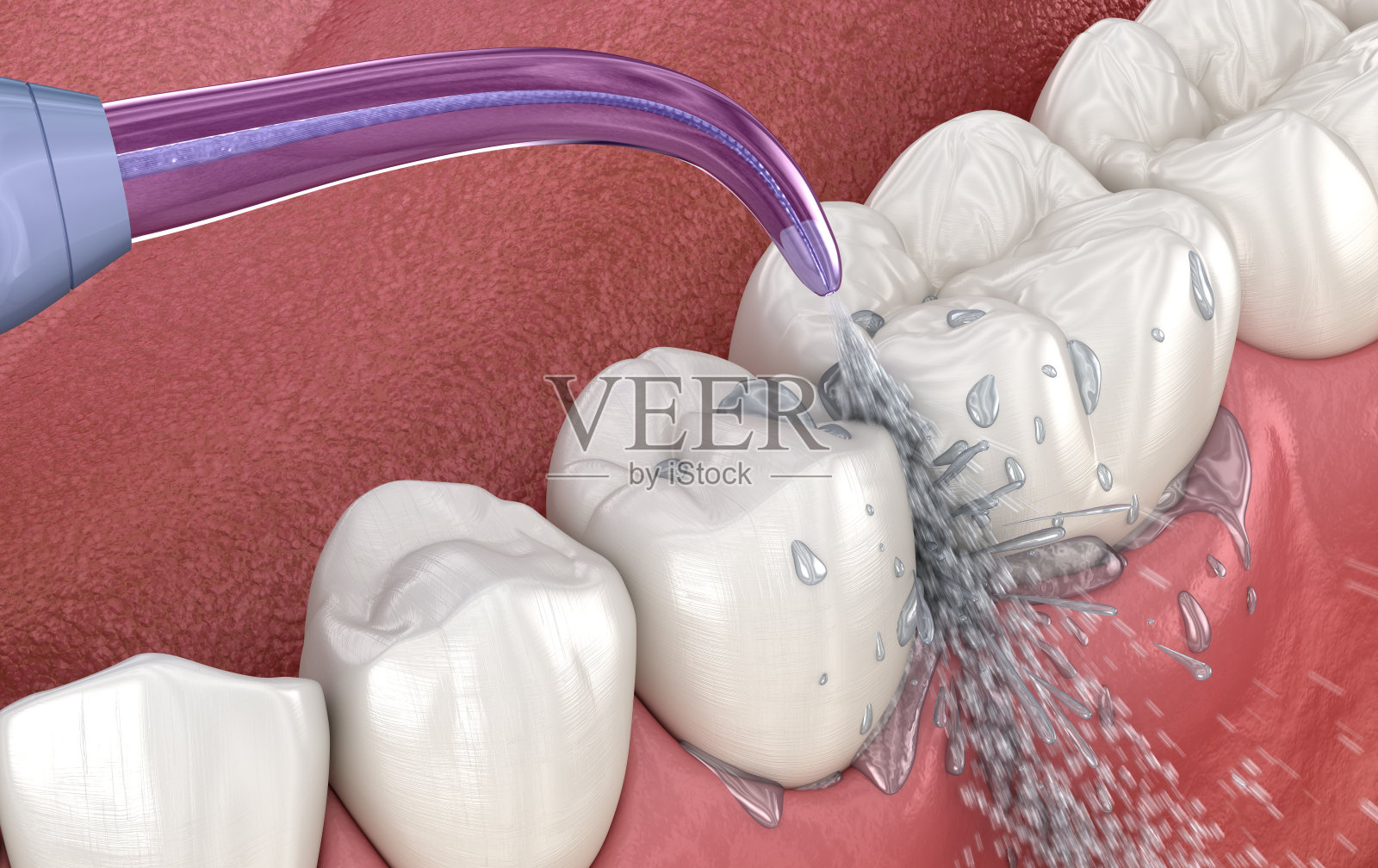 口腔冲洗器，清水清洁牙齿。医学上精确的口腔卫生3D插图。照片摄影图片