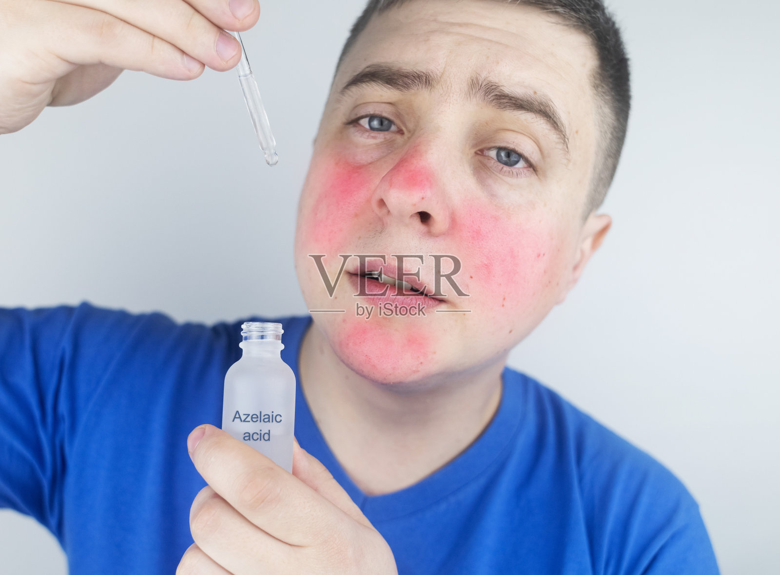 壬二酸。男人在她脸上涂了氮烯。实验室研究。面部皮肤护理。皮肤血清。乳剂用于治疗酒渣鼻，痤疮和皮肤问题照片摄影图片