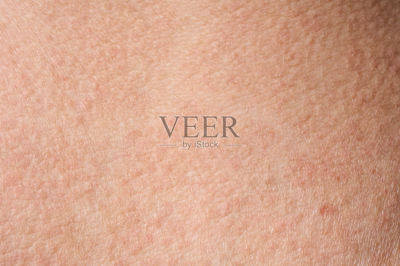 背景是粉红色的皮肤纹理。健康的皮肤。皮肤细胞微距照片。照片摄影图片